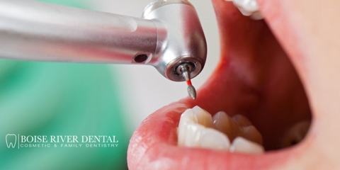 Can Dental Emergencies Be Prevented? Photo